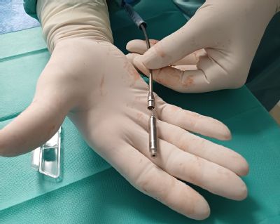 Premiéra v Pardubicích: Kardiologické centrum AGEL implantovalo nejmodernější bezsvodový kardiostimulátor