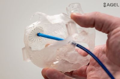 Kardiologické centrum AGEL Pardubice provedlo jako první v ČR unikátní zákrok za pomoci nového katetru a 3D modelu srdce